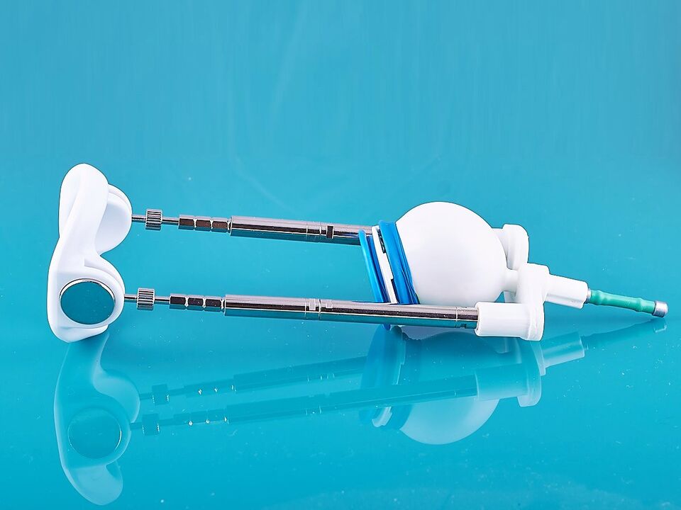 Extender – a device for increasing the length of the penis